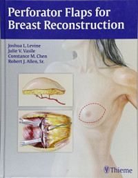 Joshua L. Levine, Julie V. Vasile, Constance M. Chen, Robert Johnson Allen — Perforator Flaps for Breast Reconstruction