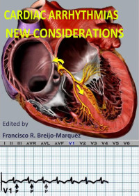 Cardiac Arrhythmias New Considerations 2nd edition 2015 — Cardiac Arrhythmias New Considerations 2nd edition 2015