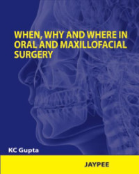 Gupta — Gupta when why where oral surgery