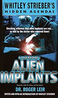 Leir Roger K. — Casebook: Alien Implants