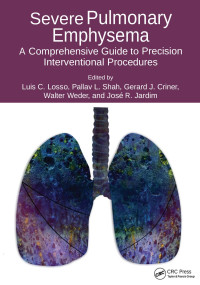 Luis C. Losso, Pallav L. Shah, Gerard J. Criner, Walter Weder, and José R. Jardim — Severe Pulmonary Emphysema