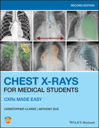 Christopher Clarke & Anthony Dux — Chest X-Rays for Medical Students