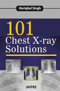 Unknown — 101 Chest X-Ray Solutions (2013) [PDF] [UnitedVRG]