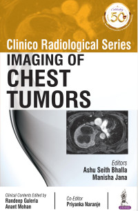 Bhalla & Jana (Editors) — Imaging of Chest Tumors