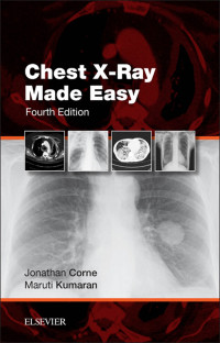 Unknown — Chest X-Ray Made Easy